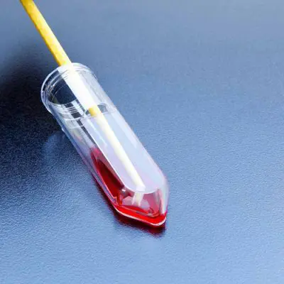 tubo-para-cultivo-de-celulas-fundo-conico-tpp-botulab-equipamentos-e-produtos-para-laboratorios